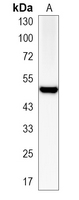 1 - Recombinant Anti-SPHK1 Rabbit mAb AP95070