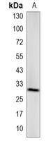 1 - Recombinant Anti-BST2 Rabbit mAb AP95071