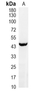 1 - Recombinant Anti-MEIS1 Rabbit mAb AP95072