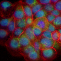 3 - Recombinant Anti-PKC epsilon Rabbit mAb AP95073