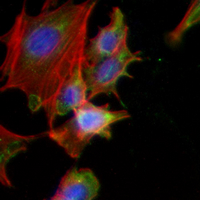 3 - Recombinant Anti-RBP4 Rabbit mAb AP95074