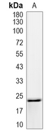 1 - Recombinant Anti-RBP4 Rabbit mAb AP95074