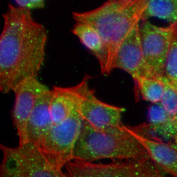3 - Recombinant Anti-TCTP Rabbit mAb AP95075