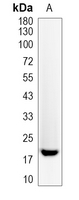 1 - Recombinant Anti-TCTP Rabbit mAb AP95075