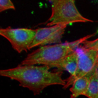 3 - Recombinant Anti-GHR Rabbit mAb AP95076