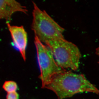 3 - Recombinant Anti-Peroxiredoxin 3 Rabbit mAb AP95078