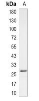 1 - Recombinant Anti-Peroxiredoxin 3 Rabbit mAb AP95078