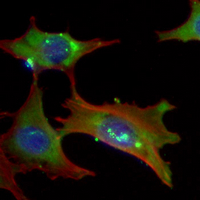 3 - Recombinant Anti-Dynamin 2 Rabbit mAb AP95082