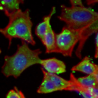 3 - Recombinant Anti-EDG2 Rabbit mAb AP95084