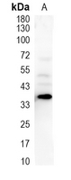 1 - Recombinant Anti-EDG2 Rabbit mAb AP95084