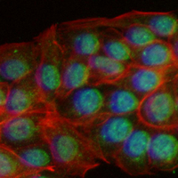 3 - Recombinant Anti-NR2F1 Rabbit mAb AP95085