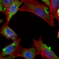 3 - Recombinant Anti-ULK3 Rabbit mAb AP95086