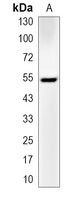 1 - Recombinant Anti-ULK3 Rabbit mAb AP95086