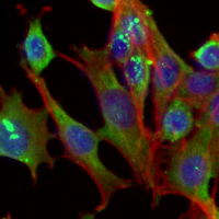 3 - Recombinant Anti-GABARAP Rabbit mAb AP95087