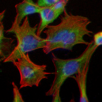 3 - Recombinant Anti-TAK1 Rabbit mAb AP95088
