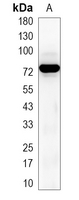 1 - Recombinant Anti-TAK1 Rabbit mAb AP95088