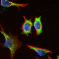 3 - Recombinant Anti-CD79a Rabbit mAb AP95089
