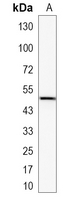 1 - Recombinant Anti-CD79a Rabbit mAb AP95089