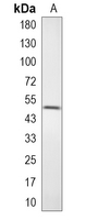 1 - Recombinant Anti-CD82 Rabbit mAb AP95090
