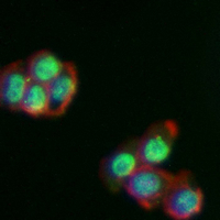 3 - Recombinant Anti-IRF4 Rabbit mAb AP95092