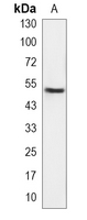 1 - Recombinant Anti-IRF4 Rabbit mAb AP95092