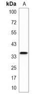 1 - Recombinant Anti-CD235a Rabbit mAb AP95093