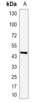 1 - Recombinant Anti-ETS1 Rabbit mAb AP95094