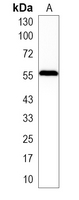 1 - Recombinant Anti-LCK Rabbit mAb AP95096