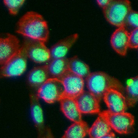 3 - Recombinant Anti-USP11 Rabbit mAb AP95099