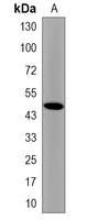 1 - Recombinant Anti-SKP2 Rabbit mAb AP95100