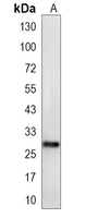1 - Recombinant Anti-FADD Rabbit mAb AP95101