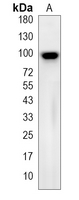 1 - Recombinant Anti-USP13 Rabbit mAb AP95102