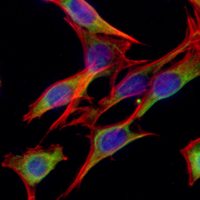3 - Recombinant Anti-GOT1 Rabbit mAb AP95103