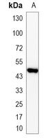 1 - Recombinant Anti-GOT1 Rabbit mAb AP95103