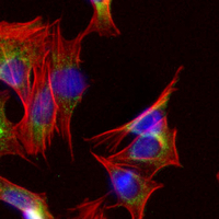 3 - Recombinant Anti-Gamma-synuclein Rabbit mAb AP95104