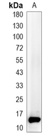 1 - Recombinant Anti-Gamma-synuclein Rabbit mAb AP95104