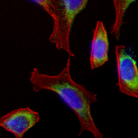 3 - Recombinant Anti-PAK1 Rabbit mAb AP95106
