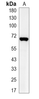 1 - Recombinant Anti-PAK1 Rabbit mAb AP95106