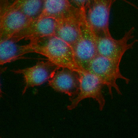 3 - Recombinant Anti-PAK2 Rabbit mAb AP95108