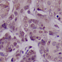 19 - Recombinant Anti-PAK2 Rabbit mAb AP95108