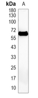 1 - Recombinant Anti-PAK2 Rabbit mAb AP95108
