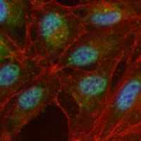 3 - Recombinant Anti-PTTG1 Rabbit mAb AP95109