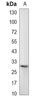 1 - Recombinant Anti-PTTG1 Rabbit mAb AP95109