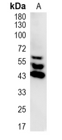 1 - Recombinant Anti-SHC1 Rabbit mAb AP95110