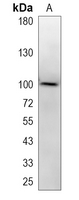 1 - Recombinant Anti-CD166 Rabbit mAb AP95111