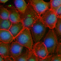 3 - Recombinant Anti-HTT Rabbit mAb AP95112