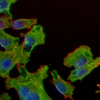 3 - Recombinant Anti-TRPM7 Rabbit mAb AP95113