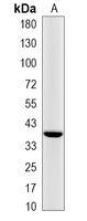 1 - Recombinant Anti-HUR Rabbit mAb AP95114