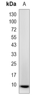 1 - Recombinant Anti-PS2 Rabbit mAb AP95116