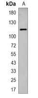 1 - Recombinant Anti-KSR1 Rabbit mAb AP95118